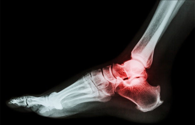 Musculoskeletal Ultrasound Scan