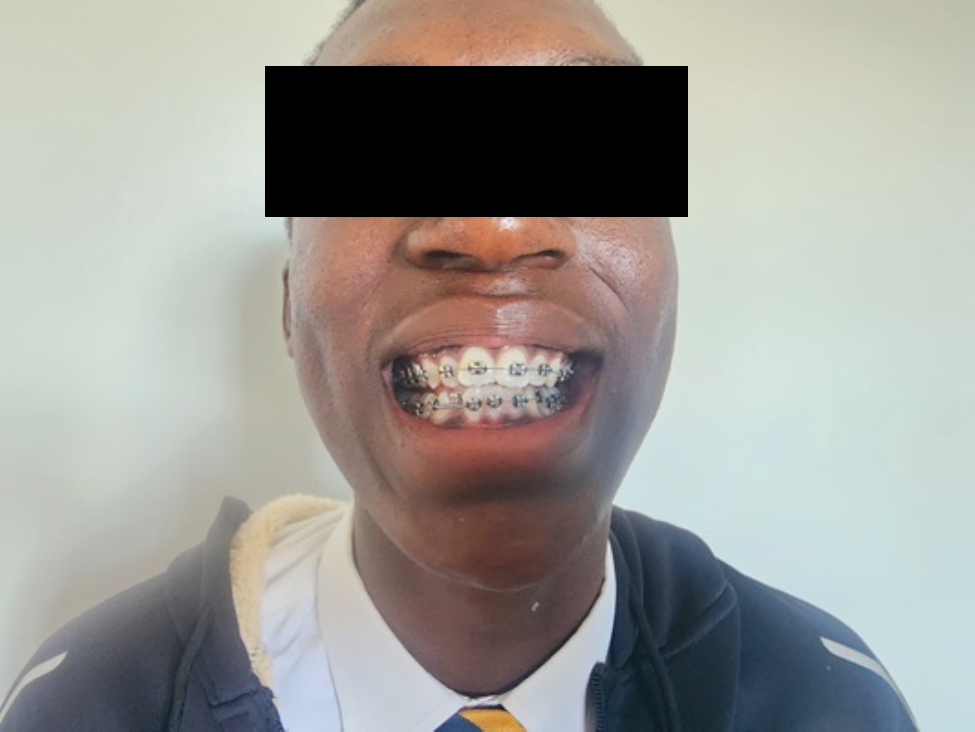 Orthodontics and Braces Treatment