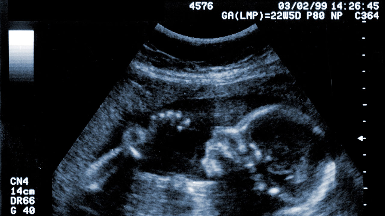 Why the Anomaly Scan is Your Baby's Most Important Photo Shoot